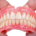 پروتز دندان چیست و چه مزایا و معایبی دارد؟